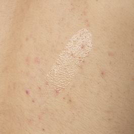 Salicylic Acid 0.5% Body Serum - Kroppsserum mot orenheter